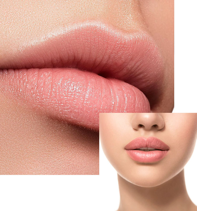 Aumento de labios