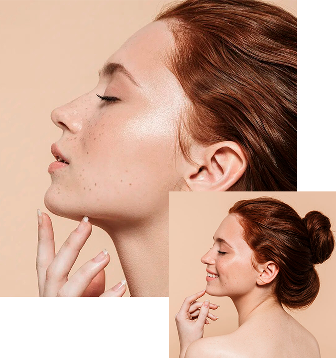Cigurgía Rinoplastia Barcelona