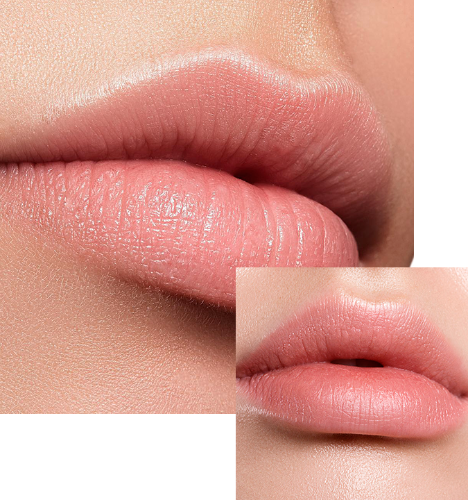Tratamiento Aumento de labios