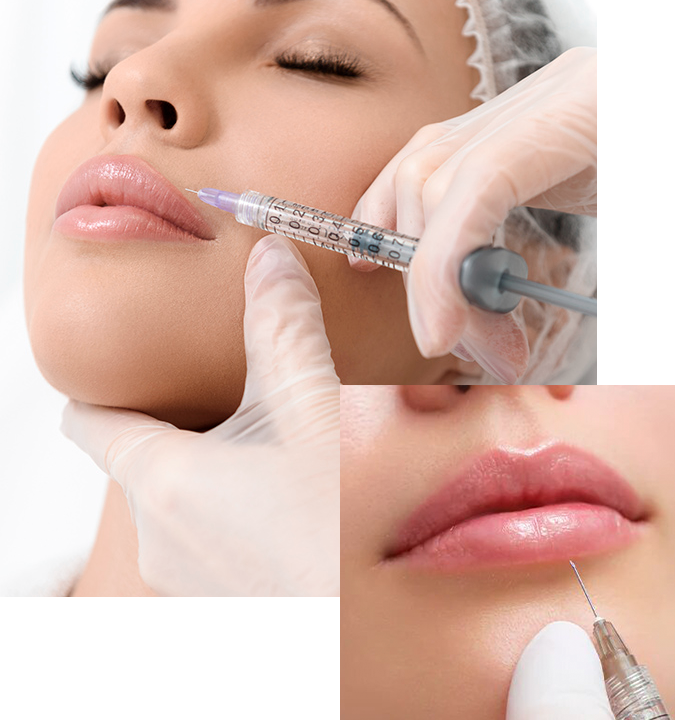 Tratamiento de Aumento de labios