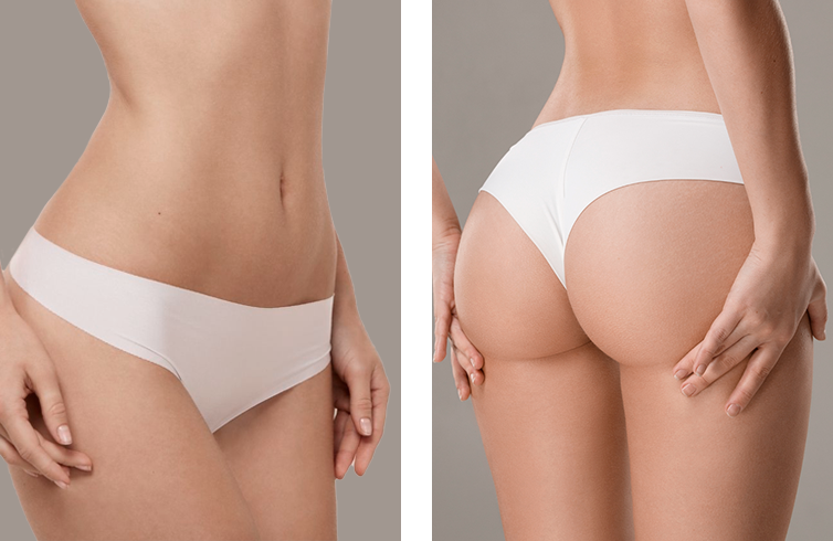Tratamiento de Lipoescultura HD