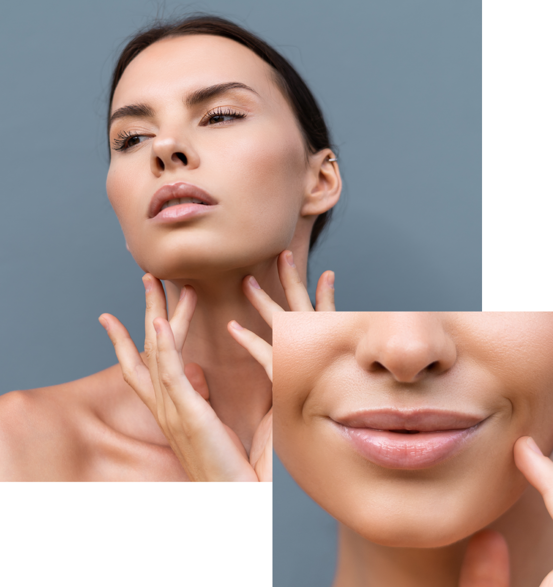 Queiloplastia