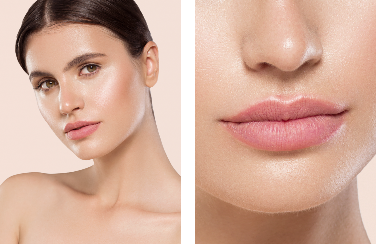 Queiloplastia