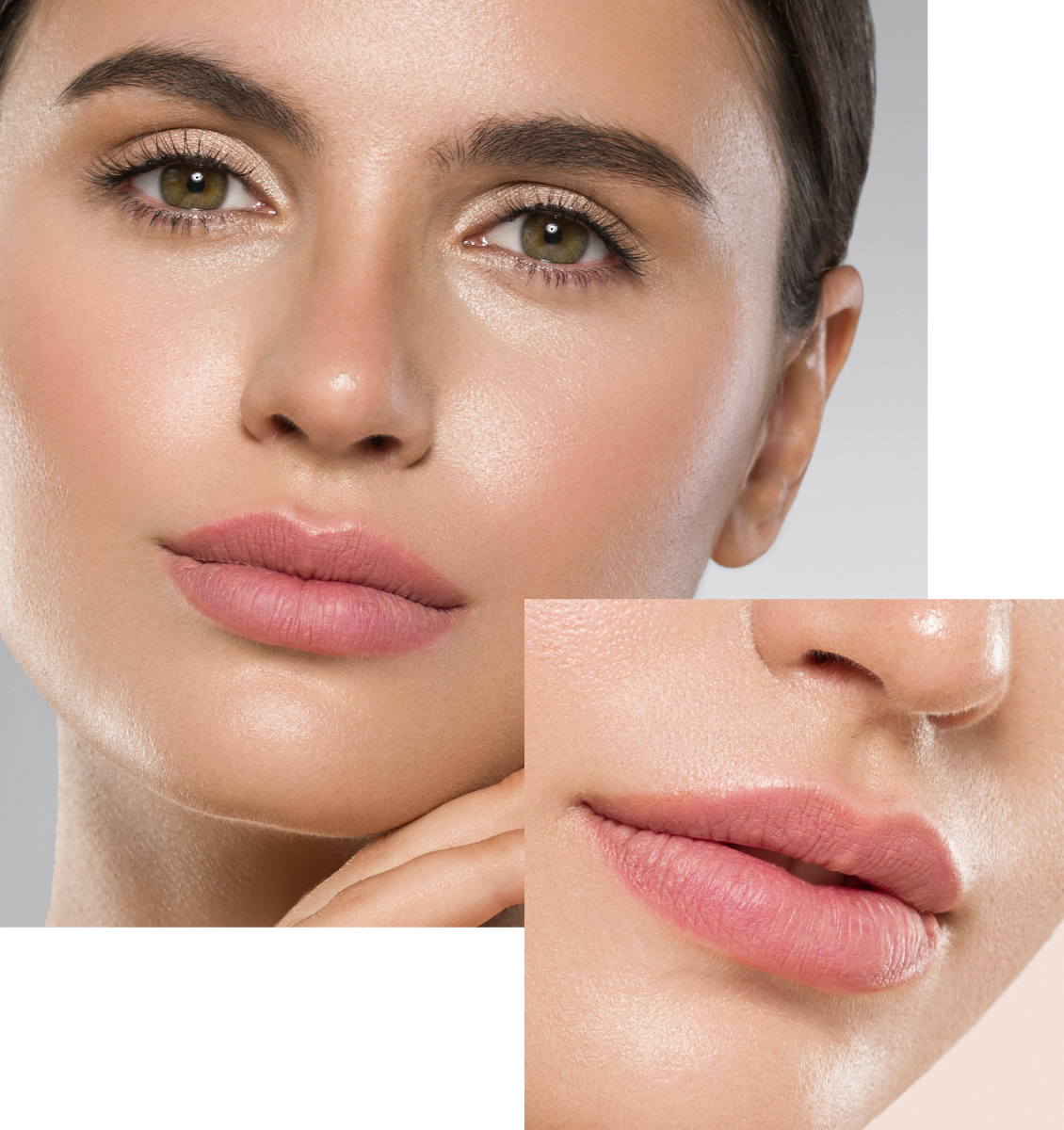 Queiloplastia