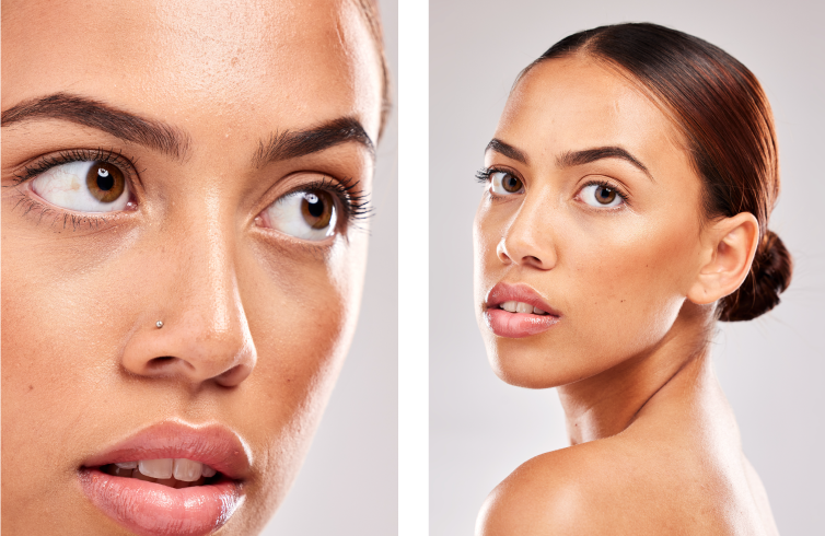 Blefaroplastia