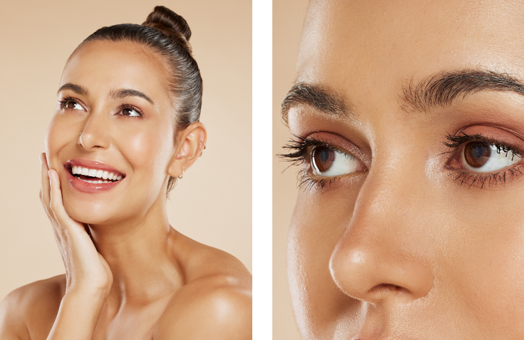 Blefaroplastia
