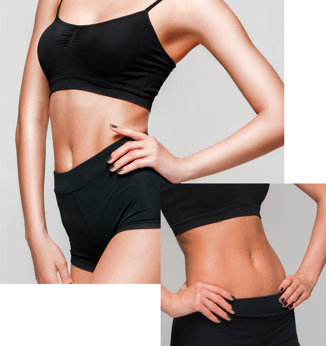 Abdominoplastia Abdominoplastia