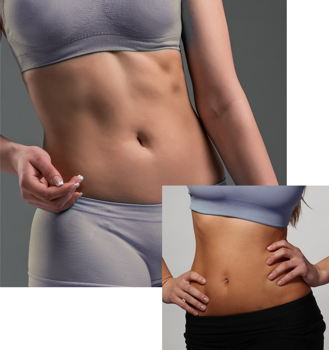 Abdominoplastia Abdominoplastia