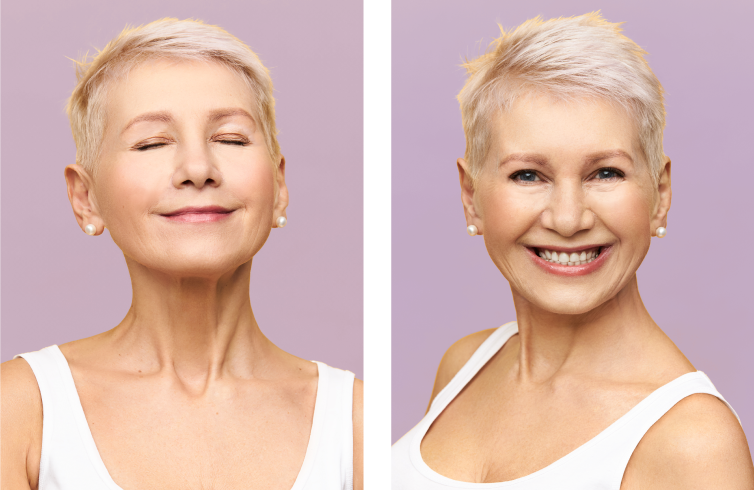rejuvenecimiento facial