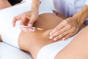 Carboxiterapia: antes y después