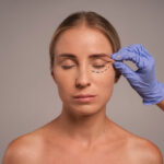 carboxiterapia para ojeras en Barcelona